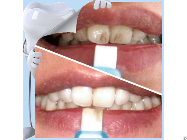 Top Sale Popular Home Use Teeth Whitening Strip