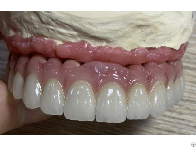 Perfect Smile Dental Regional Whitening Veneers For Teeth