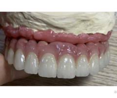 Perfect Smile Dental Regional Whitening Veneers For Teeth