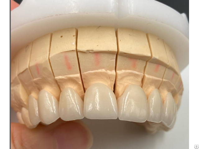 Zirconia Crowns