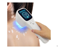 Popular Excimer Laser 308 Nm Uvb Lamp Device For Psoriasis Vitiligo Treatment