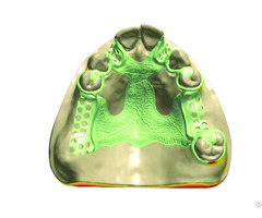 3d Laser Printed Metal Framework China Digital Dental Lab