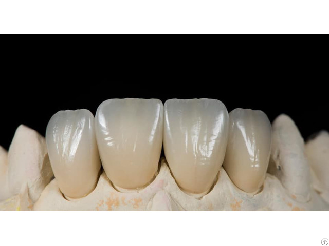 Crown And Bridge Outsourcing Chinese Dental Lab