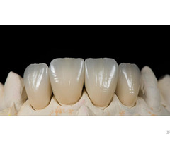 Crown And Bridge Outsourcing Chinese Dental Lab