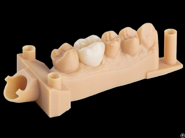 Digital Crowns Bridges China Outsourcing Dental Lab