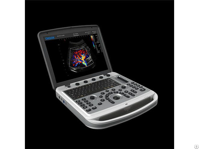 Portable Veterinary Ultrasound