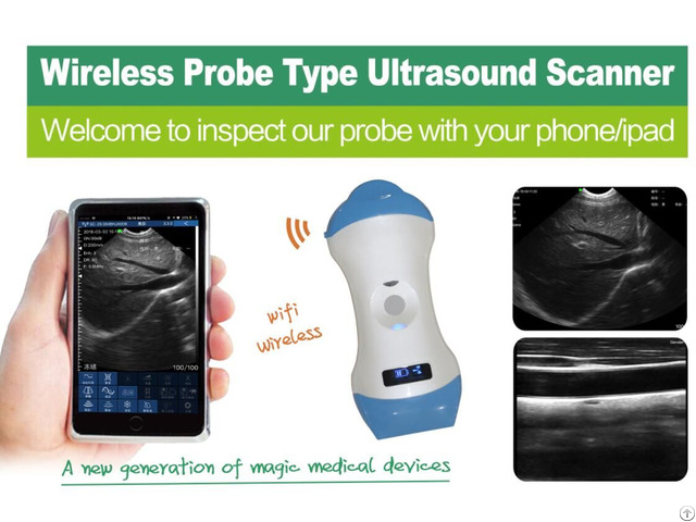 Micro Convex Linear Dual Head Wireless Probe Type Color Doppler Ultrasound Scanner