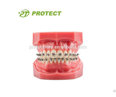 Orthodontic Training Typodont With Metal Brackets For Sale