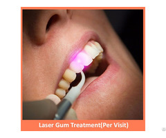 Laser Gum Treatment Per Visit