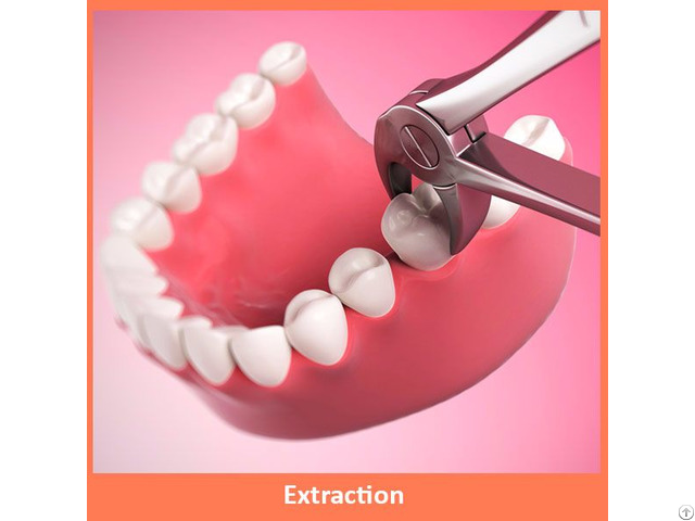 Dental Extraction