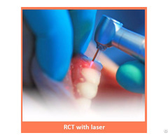 Root Canal Treatment With Laser