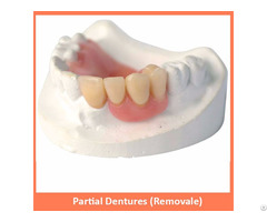 Partial Dentures Removale