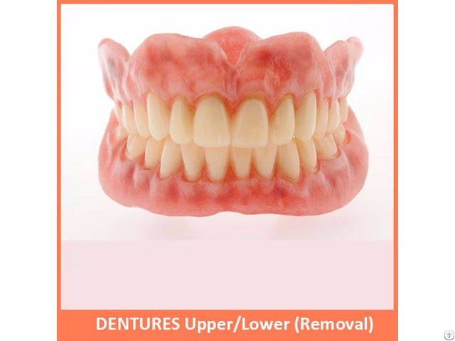 Dentures Upper Lower Removal