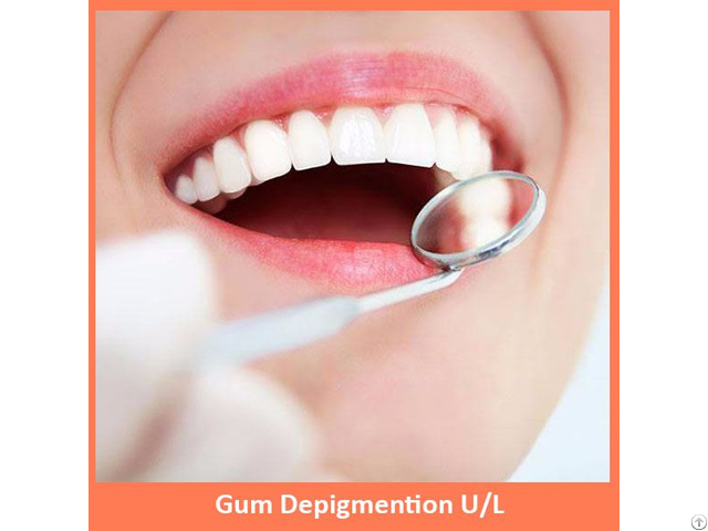 Gum Depigmention Both U L