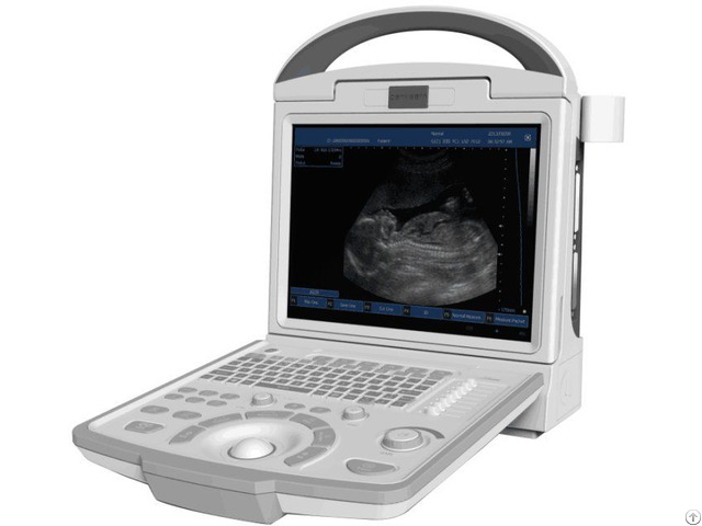 Canyearn A65 Full Digital Portable Ultrasonic Diagnostic System Black And White Ultrasound Scanner