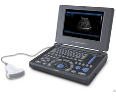 Canyearn A10 Full Digital Laptop Ultrasonic Diagnostic System
