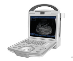 A65 Full Digital Portable Ultrasonic Diagnostic System Black And White Ultrasound Scanner
