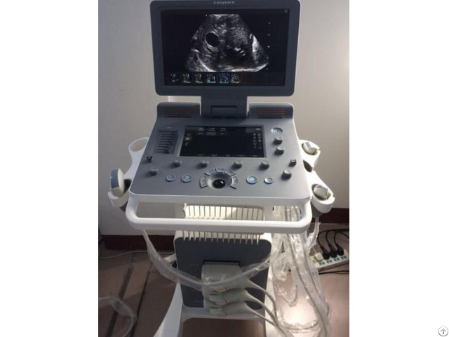 Canyearn C95 Plus Built In Trolley Color Doppler Ultrasound Scanner With Touch Screen