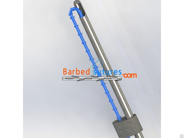 Ppdo Screw Lift Needle